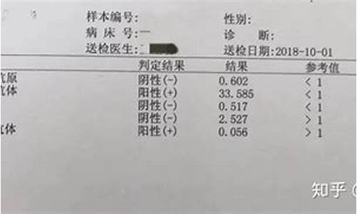 高考体检检查出艾滋_高考体检检查艾滋病吗