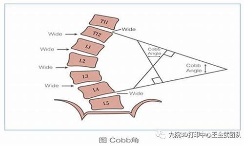 高考体检查脊柱吗,高考体检怎么查脊柱